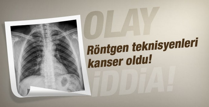 Erciyes Üniversitesi röntgen teknisyenleri kanser mi?