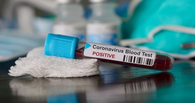 Koronavirüs Testi Hangi Hastanelerde Yapılıyor? Bakanlık Listeyi Açıkladı