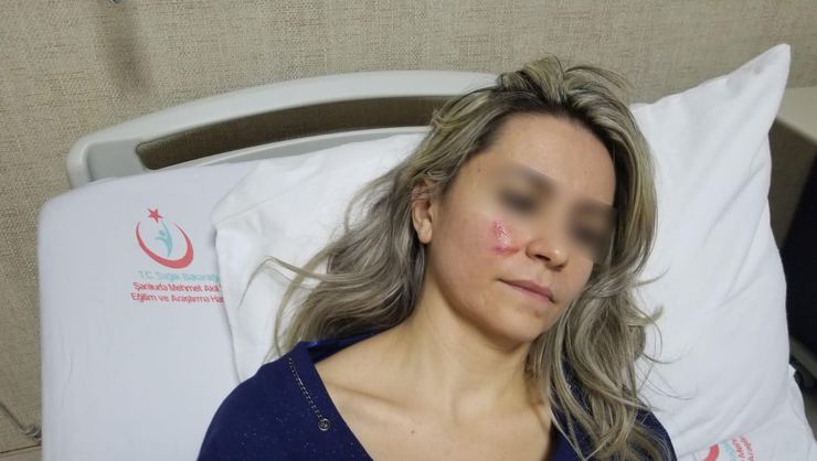 Hastane Çıkışı Kadın Doktora Saldırı