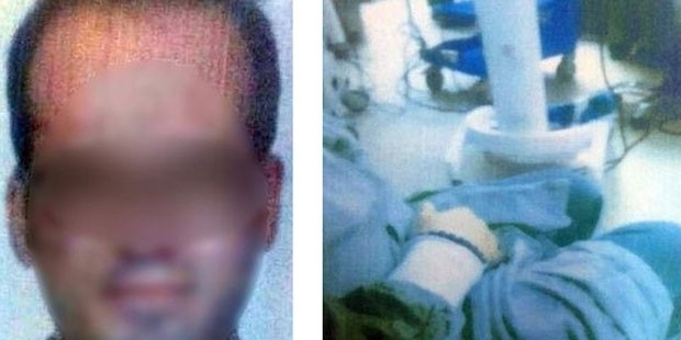 Uyutulan hastanın başında mastürbasyon yapan Anestezi Teknisyeni tutuklandı