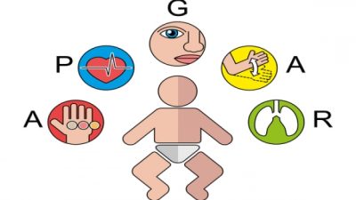 APGAR Skoru Bir bebek doğduğunda anne ve babaların ilk sorduğu