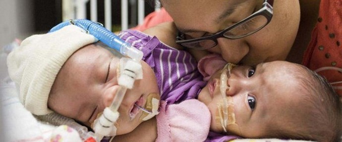 Bu ameliyata 12 cerrah, 6 anestezi uzmanı ve 8 hemşire katıldı 0