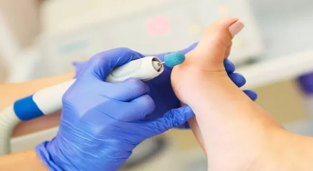 KPSS 2022/11 Yerleştirme Sonuçlarına göre 20&nbsp; Sağlık Teknikeri (Podolog) ataması