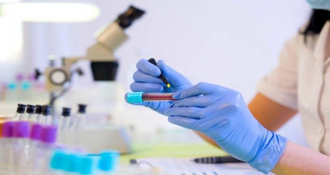 KPSS-2020/5: Sağlık Bakanlığının Sözleşmeli Pozisyonlarına Yerleştirme Sonuçları Açıklandı.KPSS 2020/5 Yerleştirme