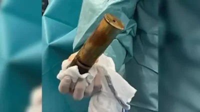 Fransa’nın güney doğusundaki Toulon’da bir hastanede eşine az rastlanan bir