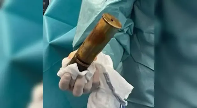 Fransa’nın güney doğusundaki Toulon’da bir hastanede eşine az rastlanan bir