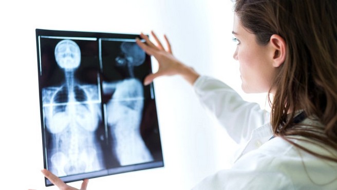 Bilgisayar Hatası Sonucu ‘207 Kadar Kadın Göğüs Kanserinden Öldü 0