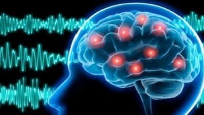 EPİLEPSİ NEDİR? Epilepsi nöbeti (yada krizi), beyin normal aktivitesinin, sinir