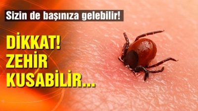 Kene Tutulması ile Gelen Hastalara Yaklaşım Algoritması Kene, hastayı ilk