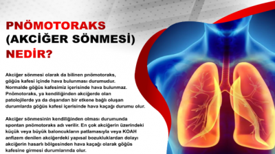 Biri, akciğer yüzeyini saran diğeri, kostaları kaplayan iki yapraktan oluşan