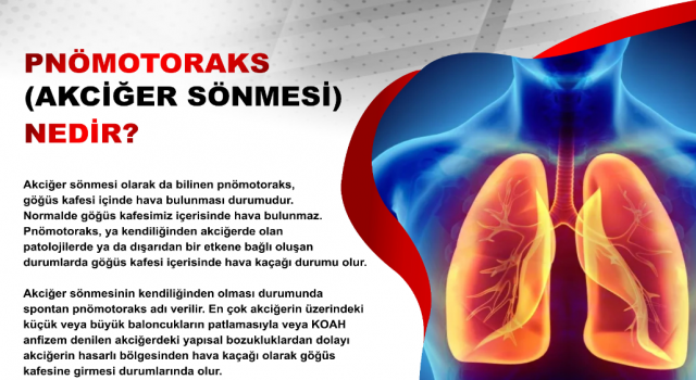 Biri, akciğer yüzeyini saran diğeri, kostaları kaplayan iki yapraktan oluşan