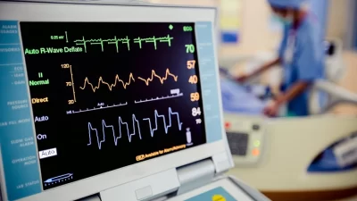 Ekg Yorumlamada En Sık Yapılan Hatalar Ekg Yorumlamada En Sık Yapılan Hatalar:EKG, kalbin elektriksel aktivitesini gösteren