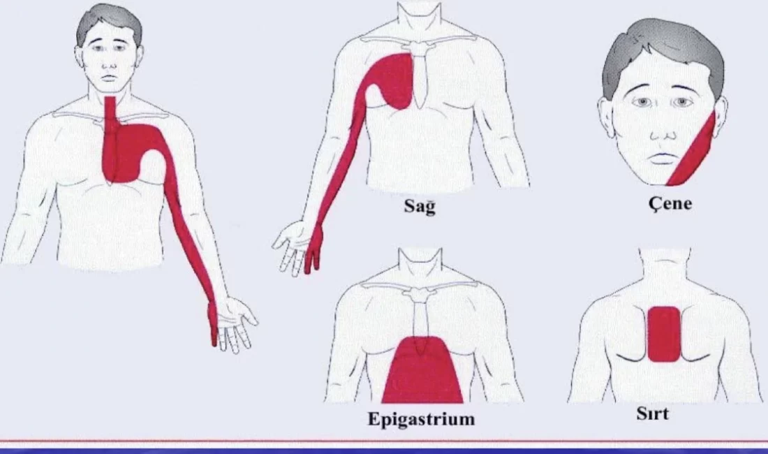 Prof. Dr. Şervan Gökhan, kalp krizinin her zaman tek bir