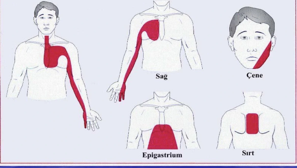 Prof. Dr. Şervan Gökhan, kalp krizinin her zaman tek bir