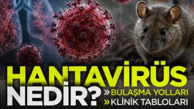 Hanta Virüs Nedir?
Hanta virüs, kemirgenler aracılığıyla insanlara bulaşan ve ciddi